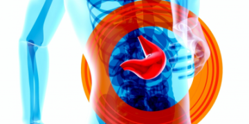 One in every five individuals is affected by fatty liver