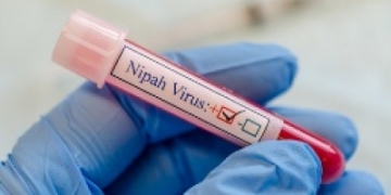Nipah monoclonal antibody to undergo human trials in India, Bangladesh in 2025