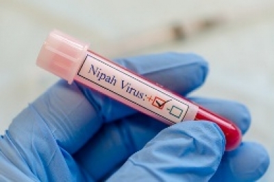 Nipah monoclonal antibody to undergo human trials in India, Bangladesh in 2025