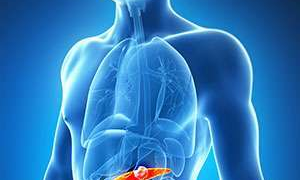 Novel method to counter chemotherapy resistance in pancreatic cancer developed