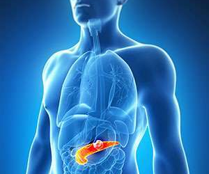Novel method to counter chemotherapy resistance in pancreatic cancer developed