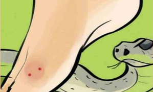 Groom dies of snake bite hours before wedding in UP’s Bulandshahr