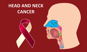 HEALTH NEWS: Head and neck cancers on the rise in India, youth at key risk: Experts