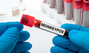 Most populous Australian state issues warning over spike in mpox cases