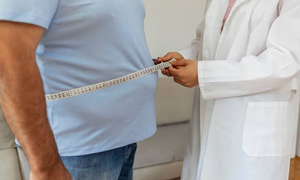 Metabolic, bariatric surgery safe & effective for severely obese patients: Study