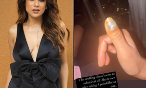 Nia Sharma reveals she is taking ‘5 painkillers a day’