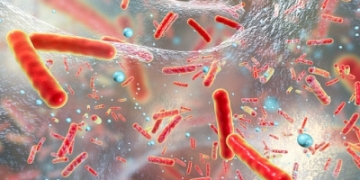 New species of superbug behind spike in severe human infections