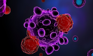 Stem cell therapy safe, and effective in treating Parkinson’s disease