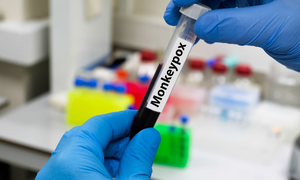 Zambia confirms second mpox death as cases rise to 49