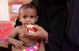 Malnutrition is ‘crisis inside the crisis’ in Yemen: NGO