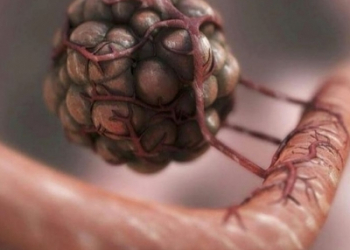 Researchers find genetic fingerprints to predict efficacy of immunotherapy