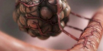Researchers find genetic fingerprints to predict efficacy of immunotherapy
