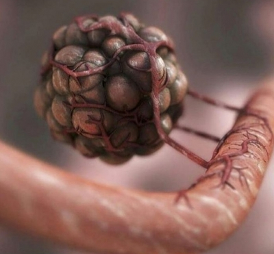 Researchers find genetic fingerprints to predict efficacy of immunotherapy