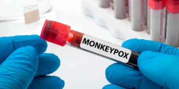 mpox virus circulating in West Africa long before 2022 global outbreak: Study