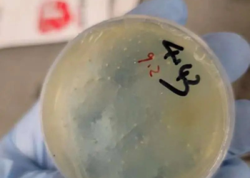 Another Chinese national arrested for smuggling ’roundworms’ into US University of Michigan