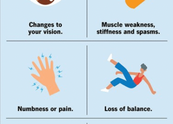 Multiple sclerosis may emerge a decade before neurological symptoms begin to appear
