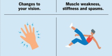 Multiple sclerosis may emerge a decade before neurological symptoms begin to appear
