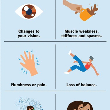 Multiple sclerosis may emerge a decade before neurological symptoms begin to appear