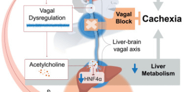 Study identifies reasons behind deadly weight loss in cancer patients