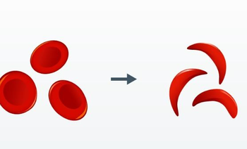 Sickle Cell elimination mission tackling genetic disorder to ensure equity, dignity: PMO