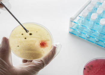 Targeted steroid use shows promise against TB