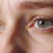 Study shows eye scans may provide clues to ageing, heart disease risk