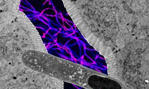 US researchers find gut bacteria that can help lose weight, boost metabolic health
