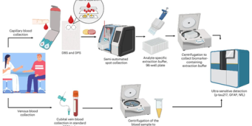 At-home blood tests can accurately detect key biomarkers of Alzheimer’s