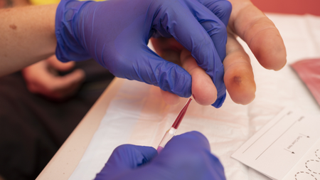 World-first fingerstick test to expand hepatitis B diagnosis access
