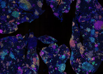 Australian study identifies early blood marker for lung cancer risk