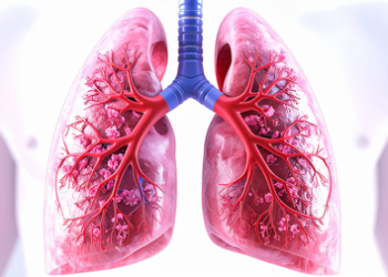lung cancer